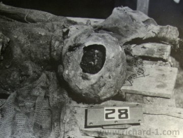 Tělo č: 28/. V levé kosti temenní a spánkové, oválný defekt 12 cm dlouhý a 8 cm široký, ostrých okrajů. Dolní čelist vlevo zlomena… Foto – Národní archív